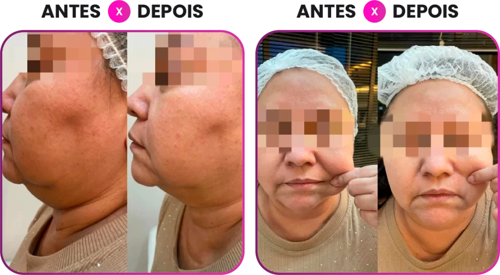 Ativo 121
